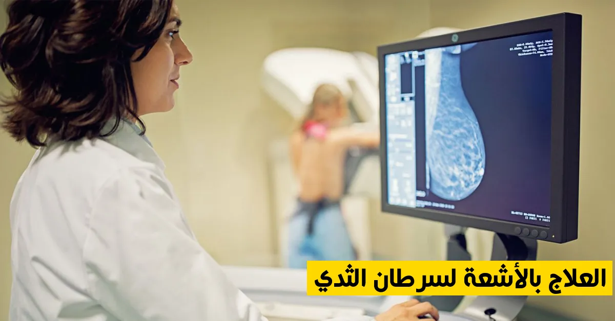 العلاج بالأشعة لسرطان الثدي